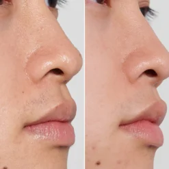 The INKEY List PHA Toner 100ml -Beauty Mix Shop 12276070 6985061808703862