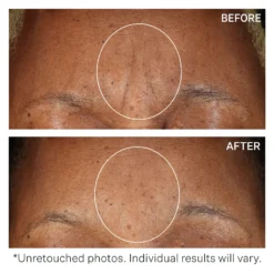 StriVectin SD Advanced PLUS Intensive Moisturising Concentrate 118ml 11 StriVectin SD Advanced PLUS Intensive Moisturising Concentrate 118ml -Beauty Mix Shop 12528621 1654886105949072