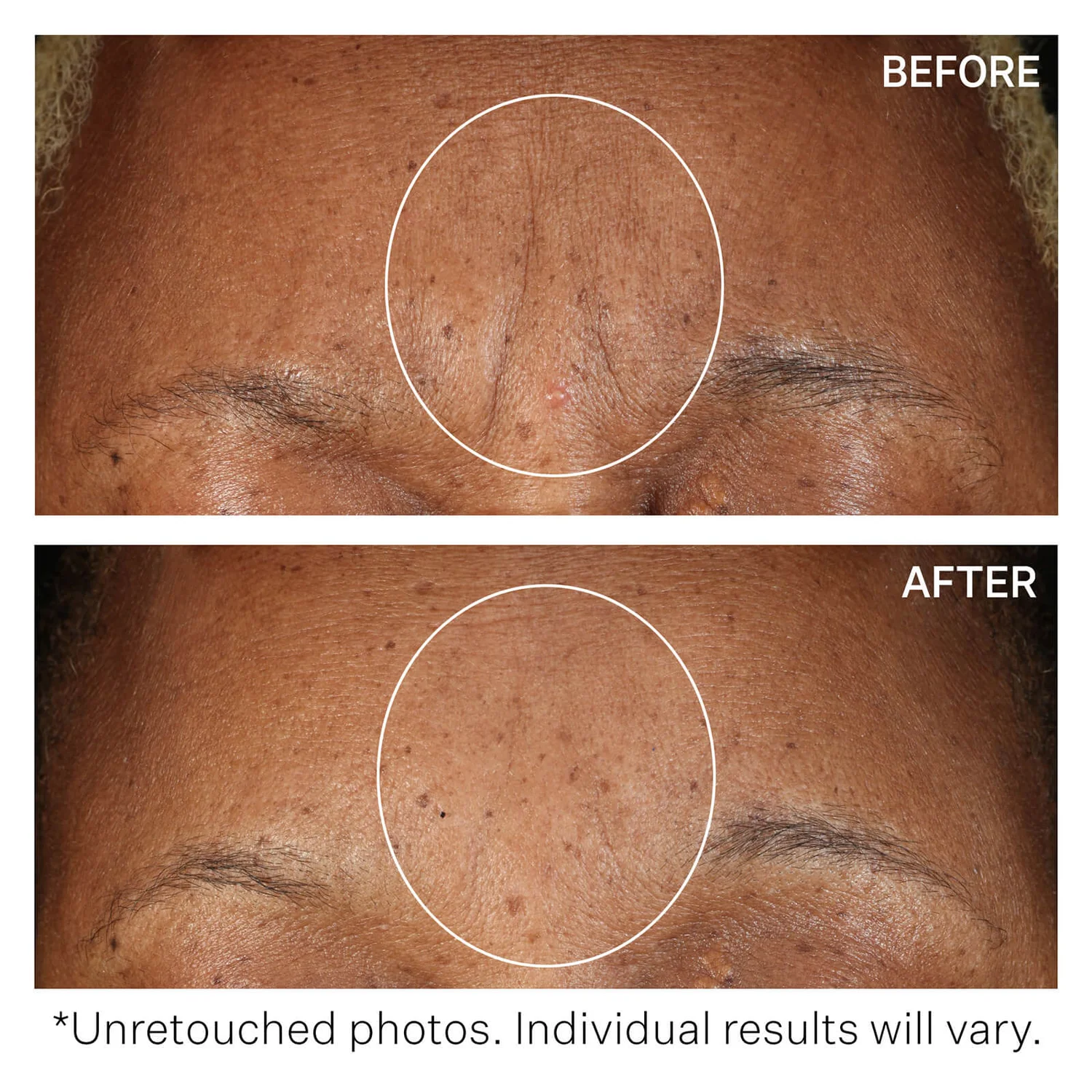 StriVectin SD Advanced PLUS Intensive Moisturising Concentrate 118ml 4 StriVectin SD Advanced PLUS Intensive Moisturising Concentrate 118ml - Image 4