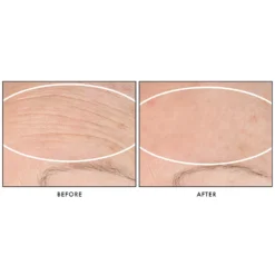 StriVectin SD Advanced PLUS Intensive Moisturising Concentrate 118ml 10 StriVectin SD Advanced PLUS Intensive Moisturising Concentrate 118ml -Beauty Mix Shop 12528621 1734980889853454