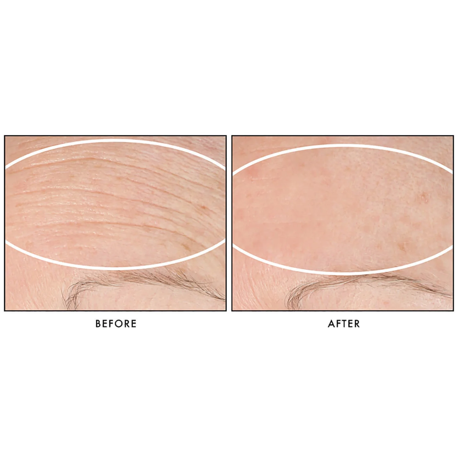 StriVectin SD Advanced PLUS Intensive Moisturising Concentrate 118ml 3 StriVectin SD Advanced PLUS Intensive Moisturising Concentrate 118ml - Image 3