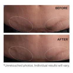 StriVectin SD Advanced PLUS Intensive Moisturising Concentrate 118ml 13 StriVectin SD Advanced PLUS Intensive Moisturising Concentrate 118ml -Beauty Mix Shop 12528621 1864886106082638