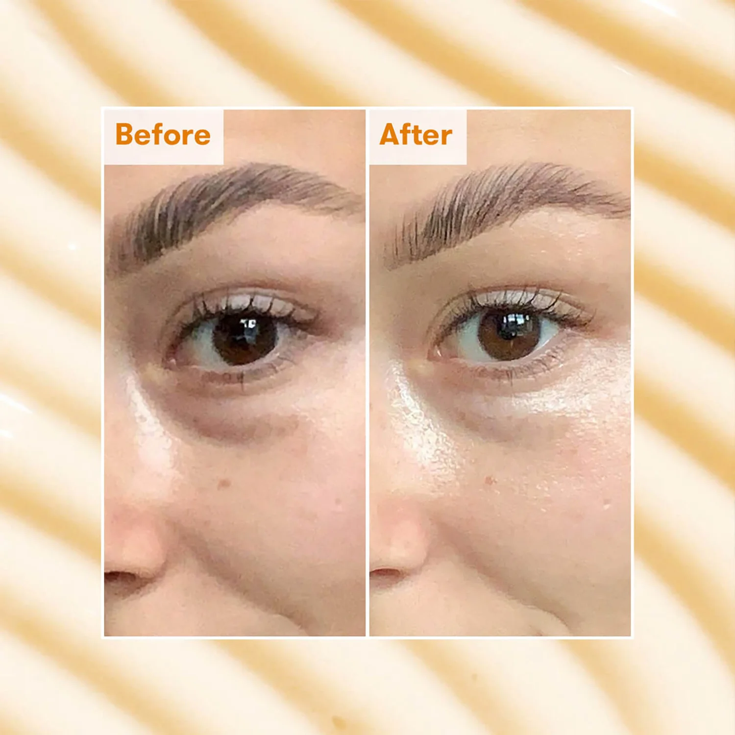 REN Clean Skincare Radiance Brightening Dark Circle Eye Cream 15ml 2 REN Clean Skincare Radiance Brightening Dark Circle Eye Cream 15ml - Image 2